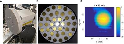 Physiological Validation of an Airborne Ultrasound Based Surface Motion Camera for a Contactless Characterization of Breathing Pattern in Humans